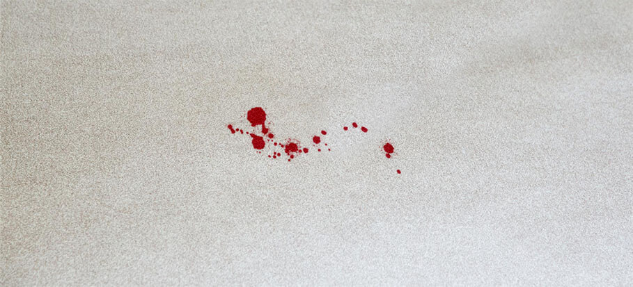 Blood Stain From a Carpet1
